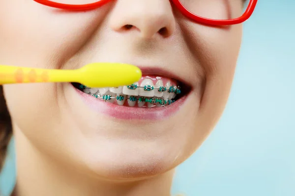 Mujer con ortodoncia usando cepillo — Foto de Stock