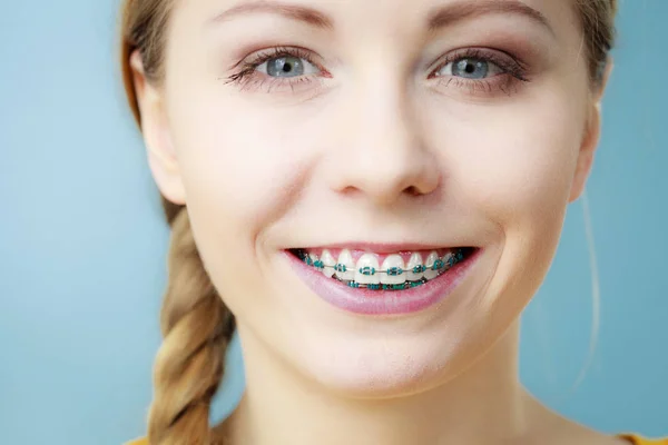 Young woman showing teeth braces — Stock Photo, Image