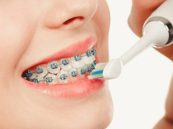 Vrouw glimlachend schoonmaken tanden met beugel — Stockfoto