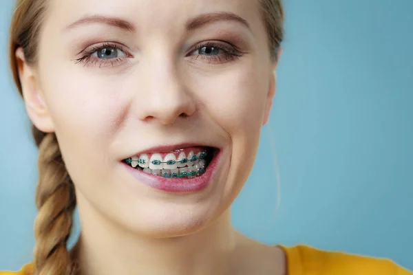 Detailní záběr zubů žena s kšandami, legrační obličej — Stock fotografie