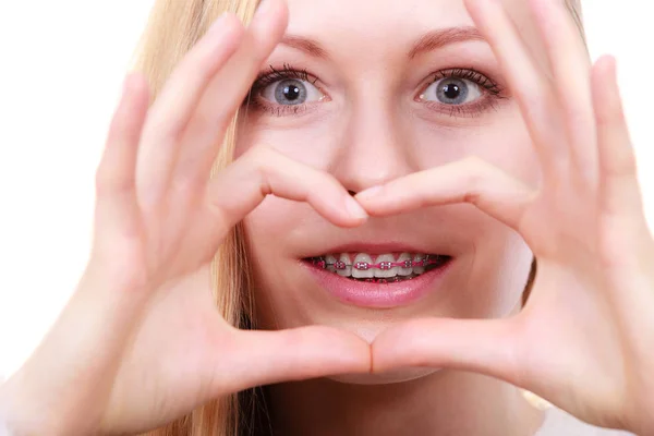 Donna felice mostrando i suoi bretelle sui denti — Foto Stock