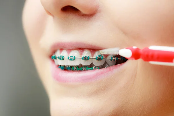 Mujer con aparatos ortopédicos usando cepillo interdental — Foto de Stock