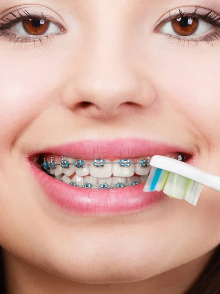 Mujer cepillándose los dientes con aparatos ortopédicos usando cepillo —  Fotos de Stock