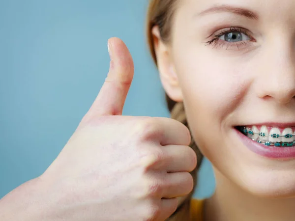 Young woman showing teeth braces — Stock Photo, Image