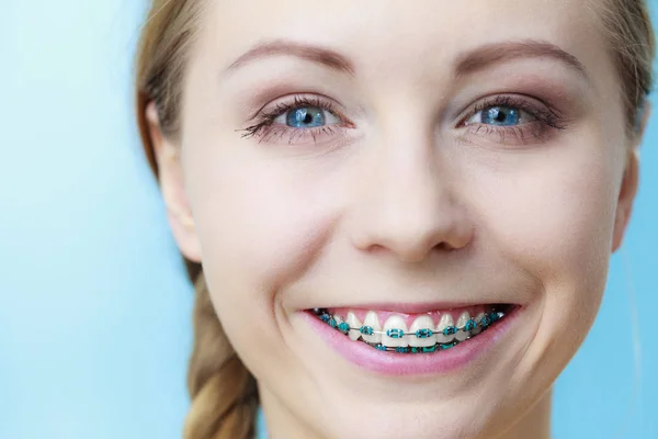 Jovem mostrando aparelho dentário — Fotografia de Stock