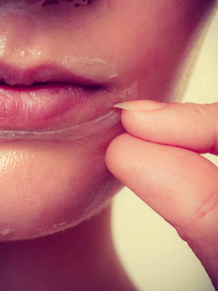 Mujer quitando la piel facial de la máscara de primer plano —  Fotos de Stock