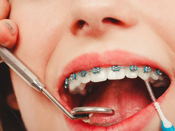 Woman smiling cleaning teeth with braces