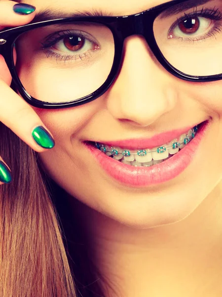 Happy nerdy tiener met brace dragen brillen — Stockfoto