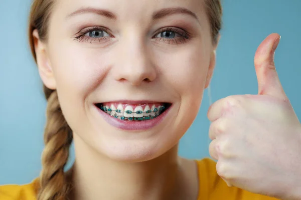 Молодая женщина показывает зубы брекеты — стоковое фото