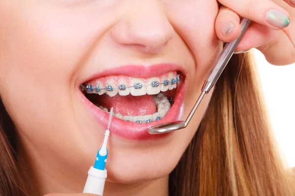 Woman with braces having dentist appointment — Stock Photo, Image