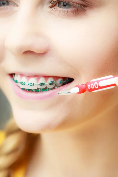 Žena s rovnátka zubů pomocí mezizubní kartáček — Stock fotografie