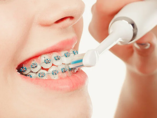 Woman smiling cleaning teeth with braces — Stock Photo, Image