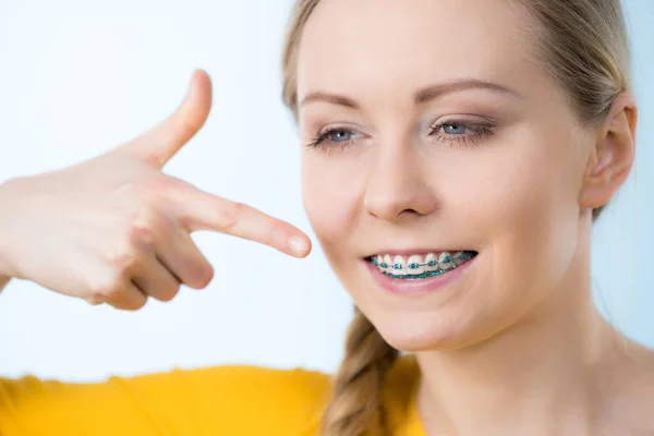 Donna che mostra i denti con l'apparecchio — Foto Stock