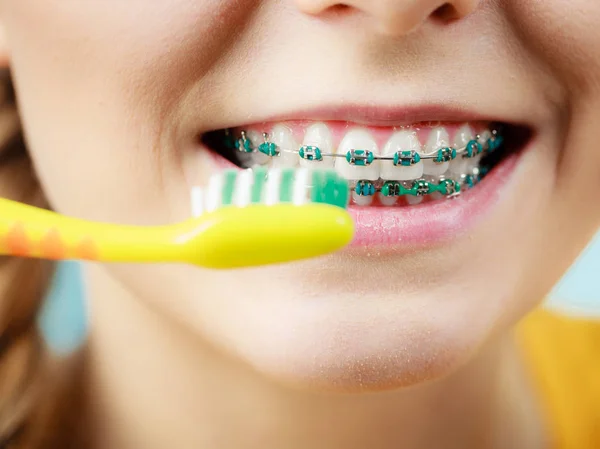 Mulher com aparelho de dentes usando escova — Fotografia de Stock