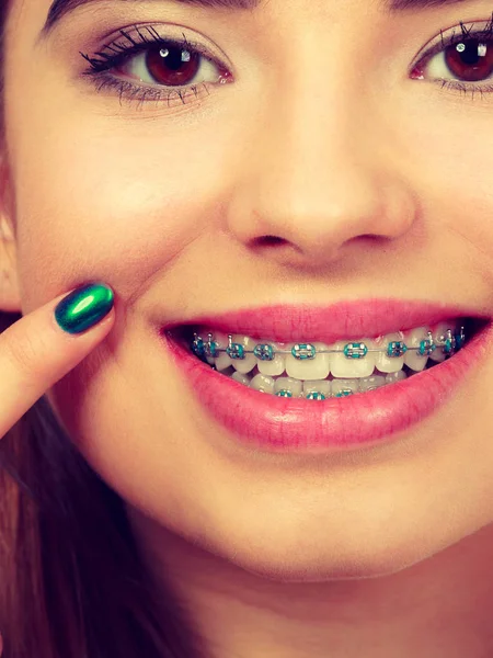 Mujer mostrando sus dientes con aparatos ortopédicos —  Fotos de Stock