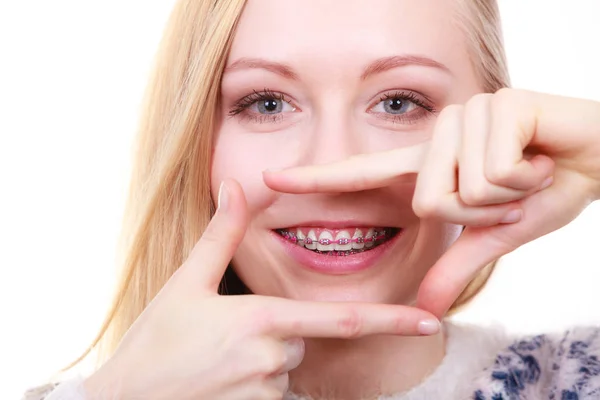 Lycklig kvinna visar sin tandställning på tänderna — Stockfoto