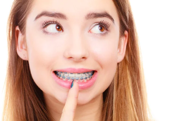 Жінка посміхається, показуючи зуби з брекетами — стокове фото