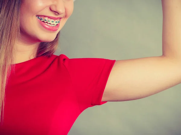 Gülümseyen kadın diş telleri üzerinde dişlere sahip olmak. — Stok fotoğraf