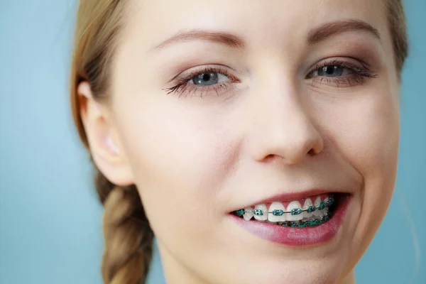 Fechar os dentes da mulher com aparelho, rosto engraçado — Fotografia de Stock