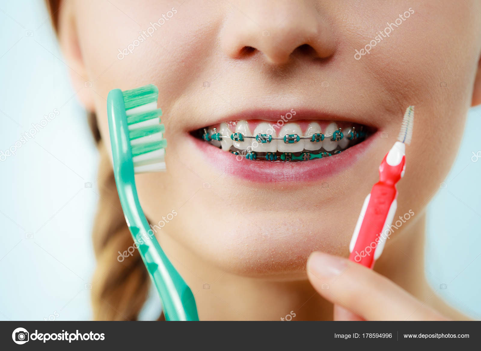 Interdental Brushes For Braces