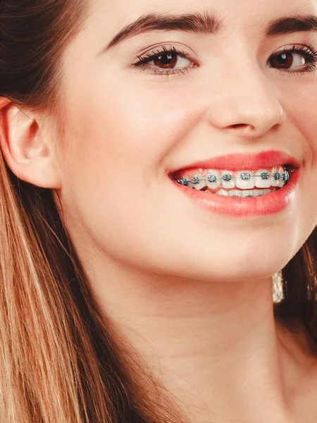 Mulher sorrindo mostrando dentes com aparelho — Fotografia de Stock