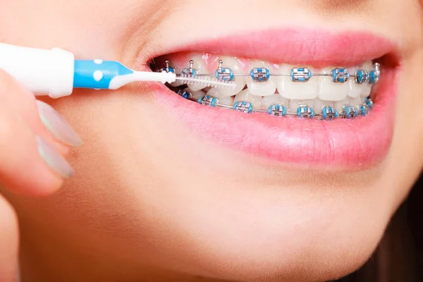 Mujer cepillándose los dientes con aparatos ortopédicos usando cepillo —  Fotos de Stock