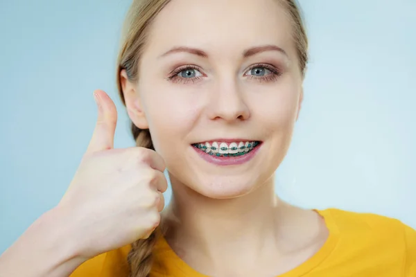 Jovem mostrando aparelho dentário — Fotografia de Stock