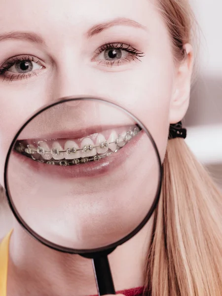 Happy woman showing her braces in magnifying glass — Stock Photo, Image