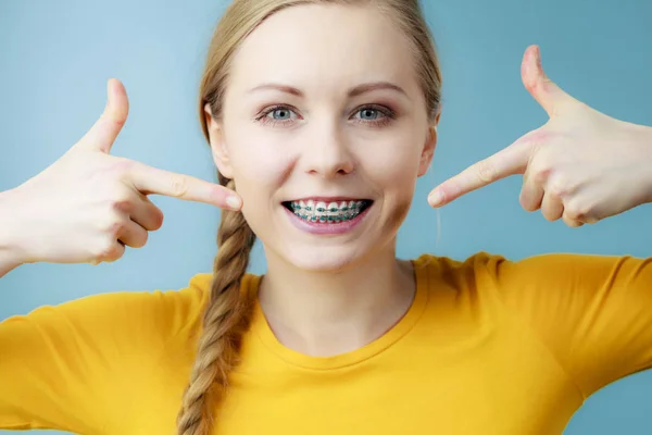 Giovane donna che mostra denti bretelle — Foto Stock