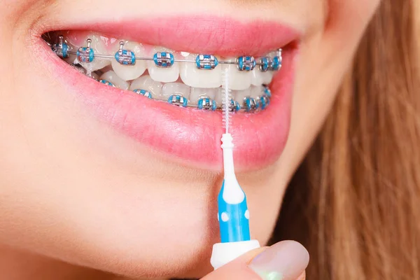 Woman brushing teeth with braces using brush — Stock Photo, Image