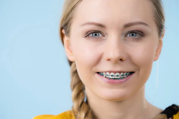 Žena ukazuje její zuby s kšandami — Stock fotografie