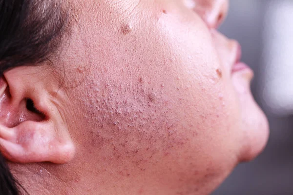 Skin face after removing hair — Stock Photo, Image