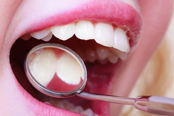 Woman teeth and dentist mouth mirror — Stock Photo, Image