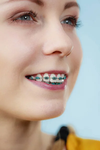 Jovem mostrando aparelho dentário — Fotografia de Stock