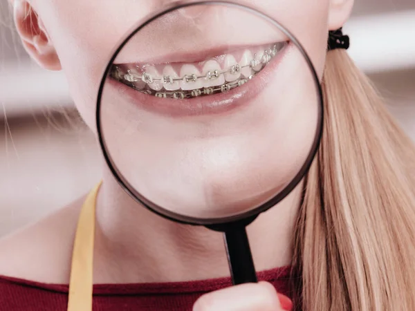 Concepto Odontología Estomatología Feliz Mujer Sonriente Mostrando Sus Aparatos Ortopédicos — Foto de Stock