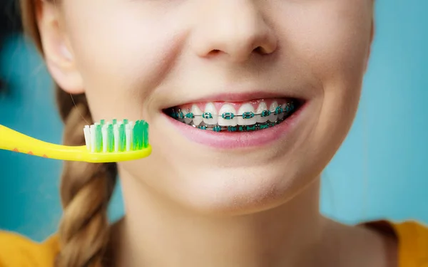 牙科医生和牙医的概念 蓝色的年轻女子大括号内的清洁和使用手动牙刷 传统刷刷牙 — 图库照片