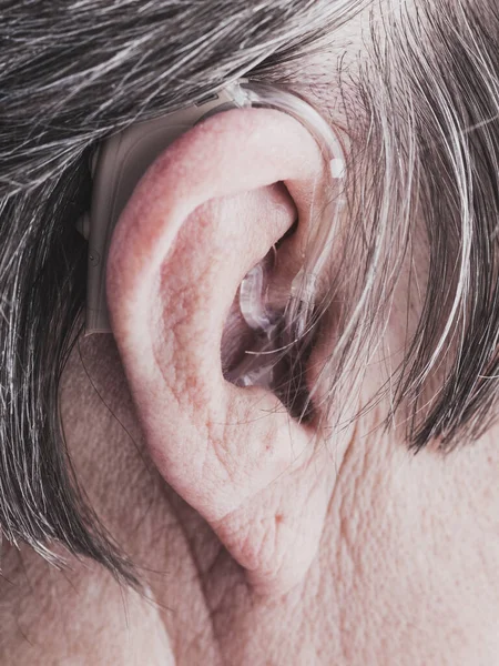 用助听器塞住老年妇女的耳朵 听力放大 聋人设备 — 图库照片