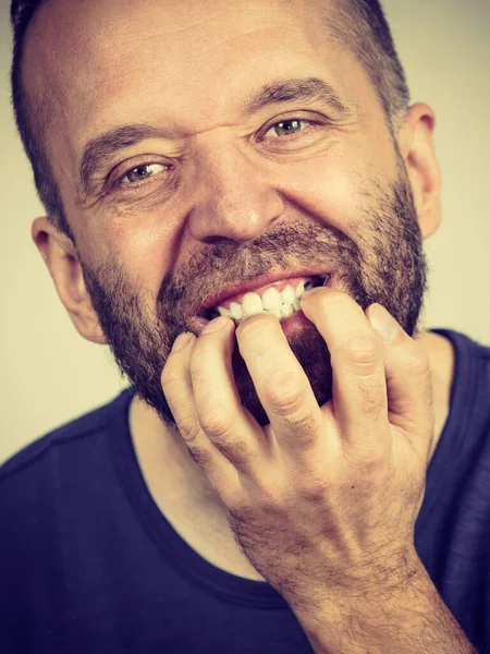 Stress Ansiedade Emoções Problemas Conceito Homem Assustado Stressado Morder Unhas — Fotografia de Stock