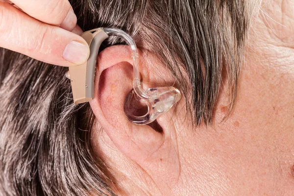 Femme Âgée Avec Prothèse Auditive Oreille Soins Santé Amplification Auditive — Photo