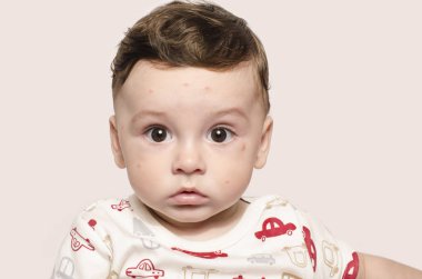 Portrait of a cute sick baby boy looking surprised at the camera. clipart