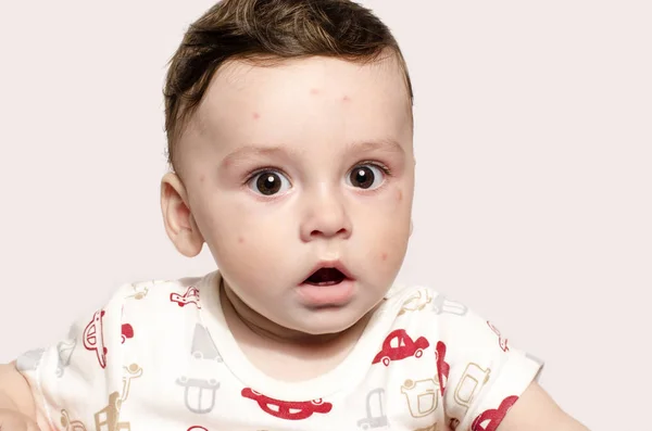 看惊讶相机可爱生病的婴儿男孩的肖像. — 图库照片