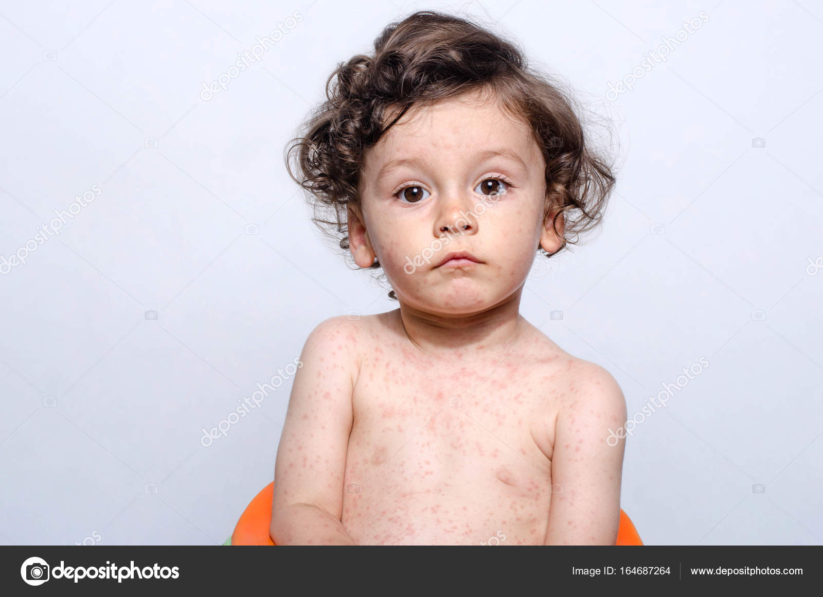 귀여운 아픈 아기의 초상화. — 스톡 사진 © luanateutzi #164687264, image size:1600x1160