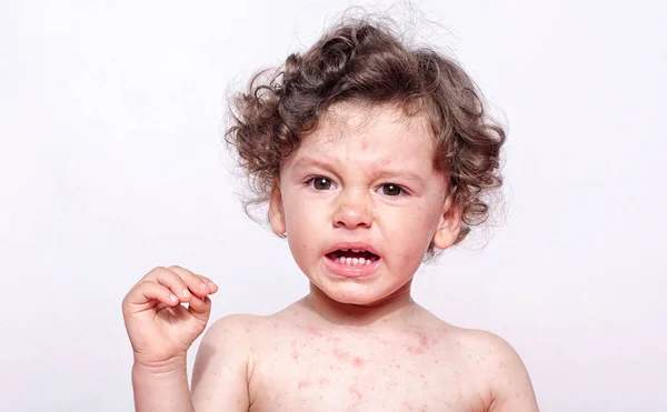 Portret van een schattige zieke baby jongen triest huilen. — Stockfoto