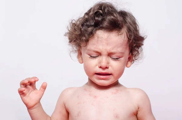 Retrato de um menino bonito doente chorando olhando para baixo para seus pontos . — Fotografia de Stock