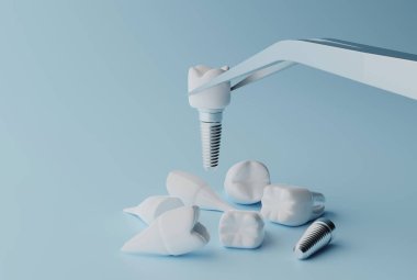 3D rendering Dental implantation concept. Human teeth or dentures tools. clipart