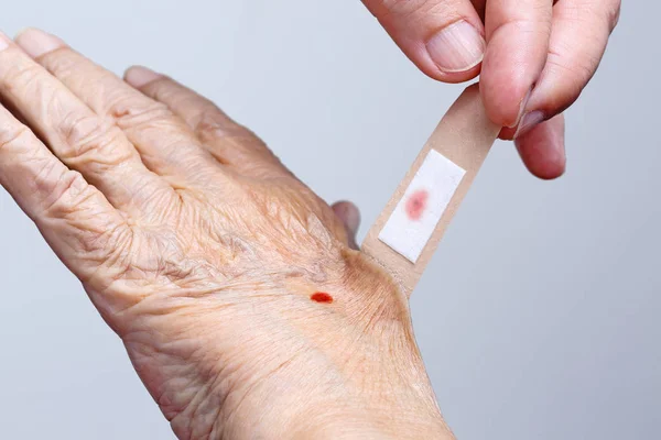 Enfermeira puxando bandagem adesiva da mão da mulher idosa — Fotografia de Stock