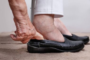 Yaşlı kadın ayakkabı üzerinde koyarak ayakları şişmiş