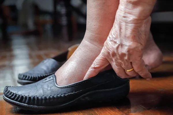 Ηλικιωμένη γυναίκα, πρησμένα πόδια, βάζοντας στα παπούτσια — Φωτογραφία Αρχείου