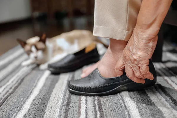 Bejaarde vrouw gezwollen voeten zetten op schoenen — Stockfoto