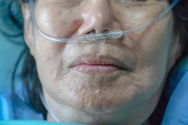 Femme âgée avec tube respiratoire nasal pour l'aider à respirer — Photo